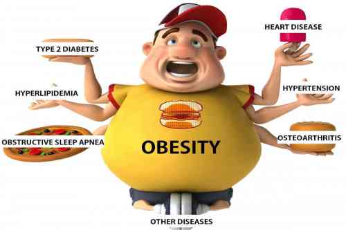obesity diseases.jpg