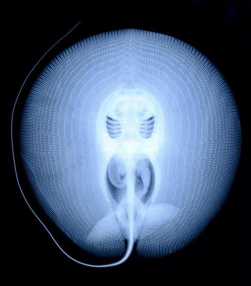 stingray-x-ray_0.jpg